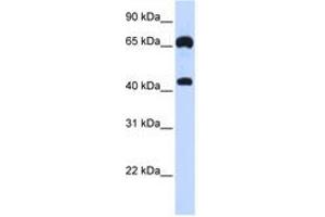 Image no. 1 for anti-Guanylate Cyclase 1, Soluble, beta 3 (GUCY1B3) (AA 180-229) antibody (ABIN6740948) (GUCY1B3 抗体  (AA 180-229))