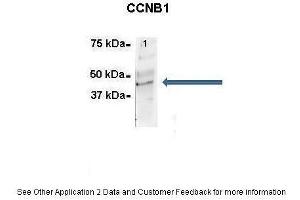 Immunoprecipitation (IP) image for anti-Cyclin B1 (CCNB1) (C-Term) antibody (ABIN2779290)