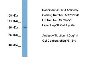 WB Suggested Anti-STK31  Antibody Titration: 0. (STK31 抗体  (N-Term))