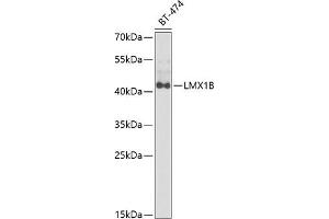 Western blot analysis of extracts of BT-474 cells, using LMX1B antibody  at 1:1000 dilution. (LMX1B 抗体  (AA 136-395))