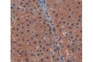Used in DAB staining on fromalin fixed paraffin- embedded Kidney tissue (CHP 抗体  (AA 2-195))