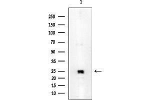 anti-Aquaporin 2 (Collecting Duct) (AQP2) antibody