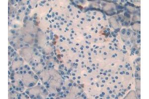 Used in DAB staining on fromalin fixed paraffin- embedded adrenal gland tissue (SLIT3 抗体  (AA 62-119))