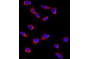 Immunofluorescence analysis of SOX9 polyclonal antibody  in HeLa cells. (SOX9 抗体  (N-Term))