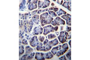 PC Antibody (N-term) (ABIN656425 and ABIN2845717) immunohistochemistry analysis in formalin fixed and paraffin embedded human pancreas tissue followed by peroxidase conjugation of the secondary antibody and DAB staining. (PC (AA 53-82), (N-Term) 抗体)