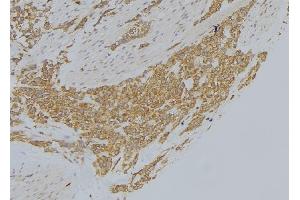 Immunohistochemistry (IHC) image for anti-Microtubule Associated Monoxygenase, Calponin and LIM Domain Containing 1 (MICAL1) (Internal Region) antibody (ABIN6263251)