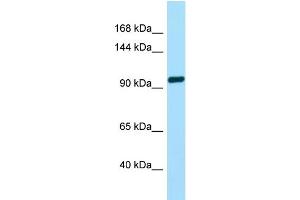 WB Suggested Anti-TAS1R2 Antibody Titration: 1. (TAS1R2 抗体  (C-Term))