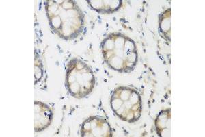 Immunohistochemistry of paraffin-embedded human colon using ACCS antibody at dilution of 1:200 (40x lens).