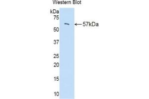 Detection of Recombinant PI16, Mouse using Polyclonal Antibody to Peptidase Inhibitor 16 (PI16) (PI16 抗体  (AA 21-468))