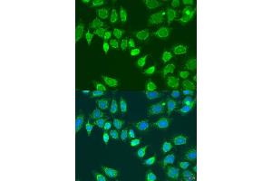 Immunofluorescence analysis of U2OS cells using L2HGDH antibody (ABIN6293250) at dilution of 1:100. (L2HGDH 抗体)