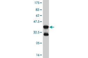 Western Blotting (WB) image for anti-Forkhead Box O1 (FOXO1) (AA 452-555) antibody (ABIN515725)