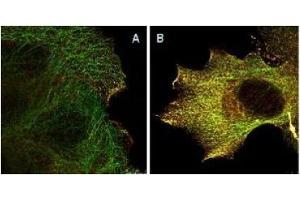 Immunofluorescence (IF) image for anti-V-Akt Murine Thymoma Viral Oncogene Homolog 1 (AKT1) (Ser473) antibody (ABIN400784) (AKT1 抗体  (Ser473))