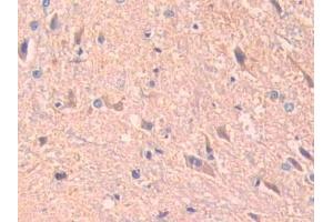 DAB staining on IHC-P; Samples: Rat Spinal cord Tissue (ADAM10 抗体  (AA 218-445))