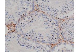 Immunohistochemistry (IHC) image for anti-Heat Shock Protein 90kDa alpha (Cytosolic), Class B Member 1 (HSP90AB1) (pSer254) antibody (ABIN6255132)