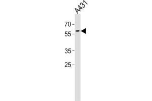 Western Blotting (WB) image for anti-Paired Box 3 (PAX3) antibody (ABIN3001734)