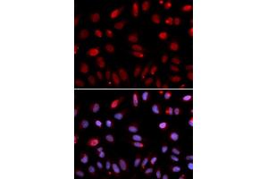 Immunofluorescence analysis of U2OS cells using HUS1 antibody (ABIN6131777, ABIN6142085, ABIN6142087 and ABIN6221056). (HUS1 抗体  (AA 1-280))