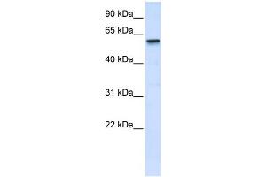 WB Suggested Anti-TRIM41 Antibody Titration:  0. (TRIM41 抗体  (Middle Region))