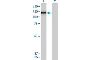 Western Blot analysis of COL6A2 expression in transfected 293T cell line by COL6A2 monoclonal antibody (M01), clone 2C5-F2. (COL6A2 抗体  (AA 1-425))