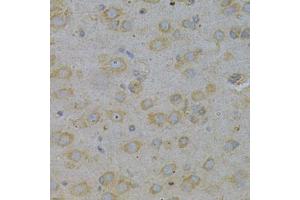 Immunohistochemistry (Paraffin-embedded Sections) (IHC (p)) image for anti-Golgi-Associated, gamma Adaptin Ear Containing, ARF Binding Protein 2 (GGA2) (AA 1-300) antibody (ABIN3021665)