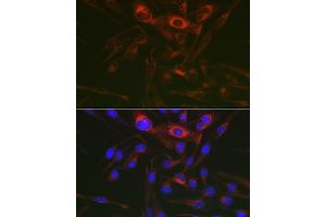 Immunofluorescence analysis of RD cells using PRK Rabbit pAb (ABIN6129909, ABIN6146189, ABIN6146191 and ABIN6218391) at dilution of 1:150 (40x lens). (PRKAG3 抗体  (AA 1-210))