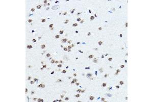 Immunohistochemistry of paraffin-embedded mouse brain using BOP1 Rabbit pAb (ABIN7265887) at dilution of 1:100 (40x lens). (BOP1 抗体  (AA 600-680))