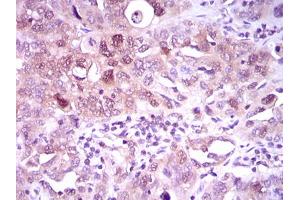 Image no. 2 for anti-ATP Citrate Lyase (ACLY) antibody (ABIN1491378) (ACLY 抗体)