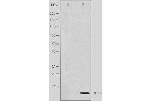 Western blot analysis of extracts from HeLa cells using COX17 antibody. (COX17 抗体  (N-Term))