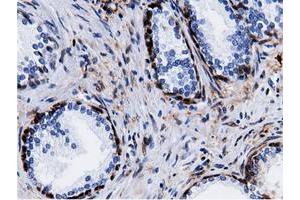 Immunohistochemical staining of paraffin-embedded Human liver tissue using anti-QPRT mouse monoclonal antibody. (QPRT 抗体)