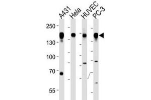 Epidermal Growth Factor Receptor antibody western blot analysis in A431, HeLa, HUVEC, PC3 lysate (EGFR 抗体  (AA 1070-1099))