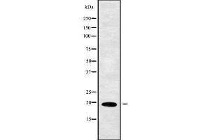 Western blot analysis of PPP3R1 using MCF7 whole cell lysates (PPP3R1 抗体  (Internal Region))