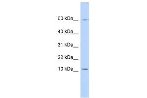 PI3 antibody used at 1 ug/ml to detect target protein. (PI3 抗体)