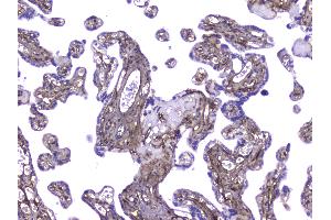Immunohistochemistry (IHC) image for anti-Collagen, Type IV, alpha 1 (COL4A1) (AA 1445-1669) antibody (ABIN5692826)