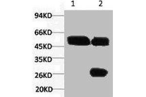 1) Input: Hela Cell Lysate 2) IP product: IP dilute 1:200 (Cytokeratin 7 抗体)