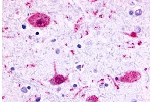 Anti-GPR17 antibody  ABIN1048754 IHC staining of human brain, neurons and glia. (GPR17 抗体  (Cytoplasmic Domain))
