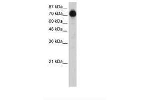 Image no. 2 for anti-Zinc Finger Protein 16 (ZNF16) (N-Term) antibody (ABIN6736214) (ZNF16 抗体  (N-Term))