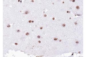 Immunohistochemistry (IHC) image for anti-Histone H4 (acLys12) antibody (ABIN6254899)