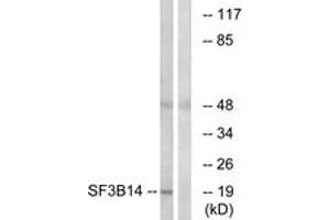 Western blot analysis of extracts from HepG2 cells, using SF3B14 Antibody. (Pre-mRNA Branch Site Protein p14 (SF3B14) (AA 76-125) 抗体)