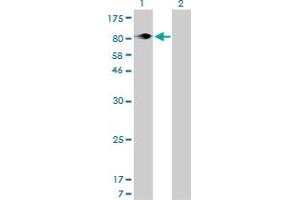 Western Blot analysis of ITGB5 expression in transfected 293T cell line by ITGB5 monoclonal antibody (M01), clone 2C4. (Integrin beta 5 抗体  (AA 421-516))