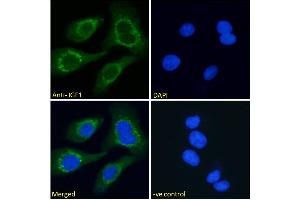 ABIN571240 Immunofluorescence analysis of paraformaldehyde fixed HEK293 cells, permeabilized with 0. (IGF1 抗体  (Internal Region))