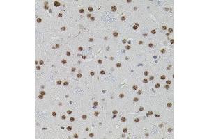 Immunohistochemistry of paraffin-embedded mouse brain using SMAD5 antibody. (SMAD5 抗体)