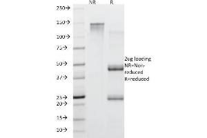SDS-PAGE Analysis Purified MUC5AC Mouse Monoclonal Antibody (45M1). (MUC5AC 抗体)