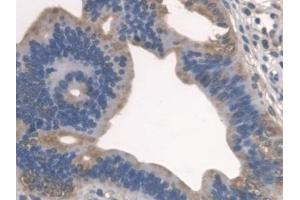 Immunohistochemistry (IHC) image for anti-serine Palmitoyltransferase, Long Chain Base Subunit 1 (SPTLC1) (AA 143-473) antibody (ABIN7436414)