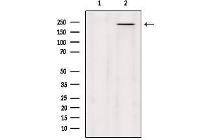 Western blot analysis of extracts from Hela, using MYO5C Antibody. (MYO5C 抗体)