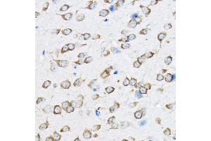 Immunohistochemistry (IHC) image for anti-Ribosomal Protein L23 (RPL23) (AA 1-140) antibody (ABIN1682575)