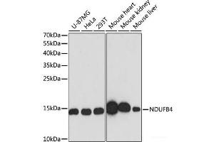 Western blot analysis of extracts of various cell lines using NDUFB4 Polyclonal Antibody at dilution of 1:3000. (NDUFB4 抗体)
