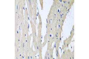 Immunohistochemistry of paraffin-embedded rat heart using PITRM1 antibody (ABIN5974837) at dilution of 1/100 (40x lens). (PITRM1 抗体)