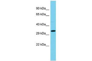 Host: Rabbit  Target Name: Ccdc42  Sample Tissue: Rat Pancreas lysates  Antibody Dilution: 1. (CCDC42 抗体  (Middle Region))
