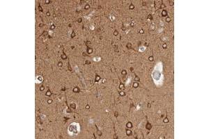 Immunohistochemical staining of human cerebral cortex with RRP15 polyclonal antibody  shows strong cytoplasmic positivity in neuronal cells at 1:200-1:500 dilution. (RRP15 抗体)