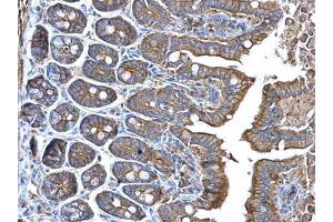 IHC-P Image alpha Adducin antibody detects alpha Adducin protein at membrane on mouse intestine by immunohistochemical analysis. (alpha Adducin 抗体)
