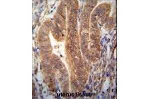 KI antibody (N-term) (ABIN654385 and ABIN2844131) immunohistochemistry analysis in formalin fixed and paraffin embedded human uterus tissue followed by peroxidase conjugation of the secondary antibody and DAB staining. (SHISAL1/KIAA1644 抗体  (N-Term))